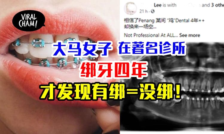 【黑心牙医！】大马女子绑牙4年，连牙洞都没填上！网友：太惨了！