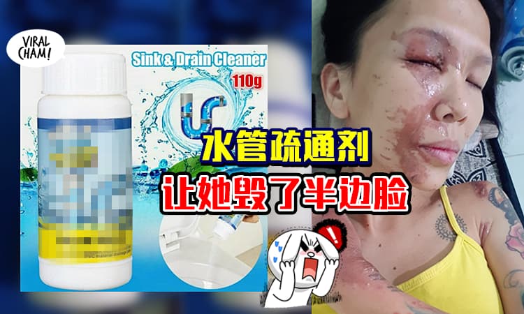 【水管堵塞・不要自己来!】女子使用疏通剂「瞬间爆炸」导致毁容😱