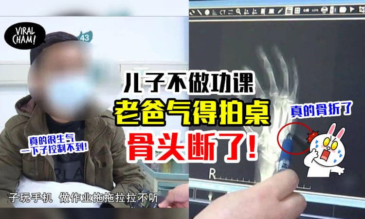 【你做么酱不听话！】儿子偷懒不做功课，老爸气得拍桌💥 竟拍到「手骨折」😱