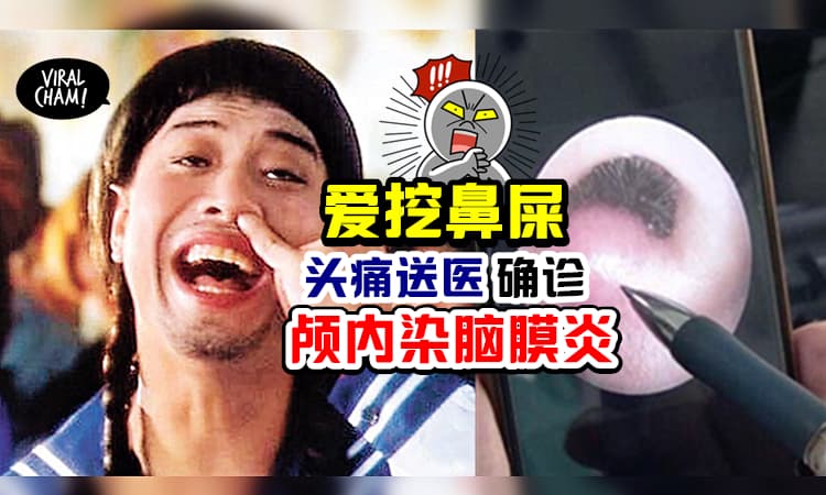 【爱挖鼻屎的你小心了❗️】习惯性挖鼻子, 8岁童头痛送医「 颅内染脑膜炎」😱
