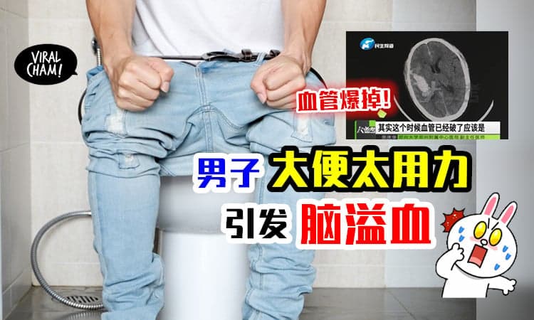 【你💩太用力了！】男子上厕所太使劲⚡ 突然头痛引发「脑溢血」😱