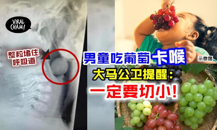 【不要整粒吞❗】5岁童吃葡萄卡喉呼吸困难入院⚡ 大马公卫：🍇应该这样切！