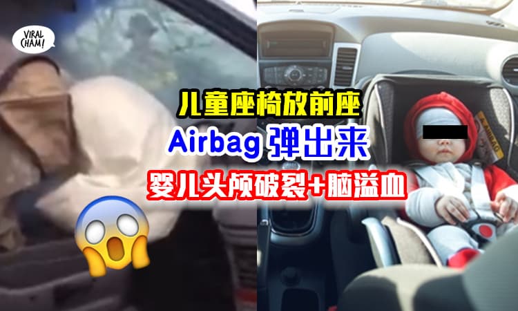 【千万不要把Carseat放前座❗️】真实案例「安全气囊弹出」⚡ 婴儿头颅破裂+脑溢血！