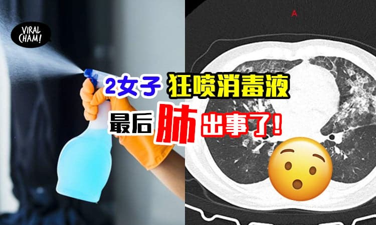【用错方法消毒❗️】2女子每天在家喷消毒液, 结果肺部惊现严重阴影！