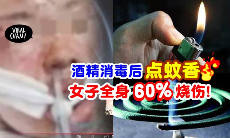 【千万别这么做！】女子喷「酒精消毒后」点蚊香⚡ 结果全身60%惨被烧伤🔥