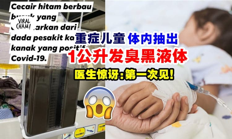 【医生都吓到❗】重症儿童体内抽出『1公升发臭黑液体』⚡ 惊讶喊：第一次见！