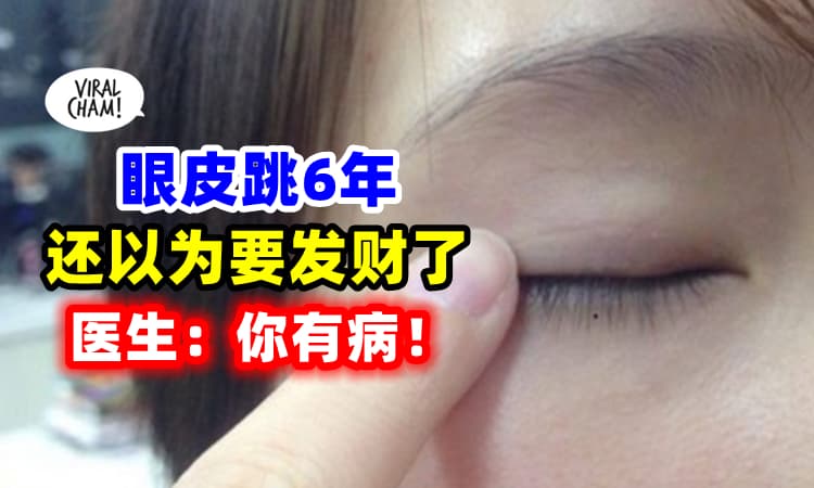 【赶紧就医❗】女子左眼皮跳6年『以为要发财』⚡ 被查出“血管压迫神经”😱