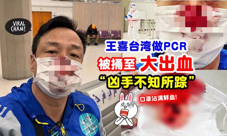 【口罩都是血😱】王喜入境台湾「做PCR被捅至大爆血」⚡ 发文控诉 : 凶手已逃