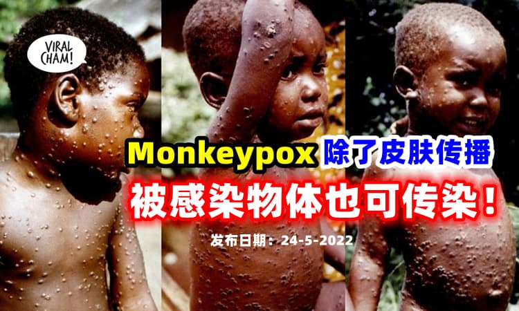【物体也可传染❗】WHO：Monkeypox可通过 『皮肤接触传播』被病毒污染的物体也可以⚡
