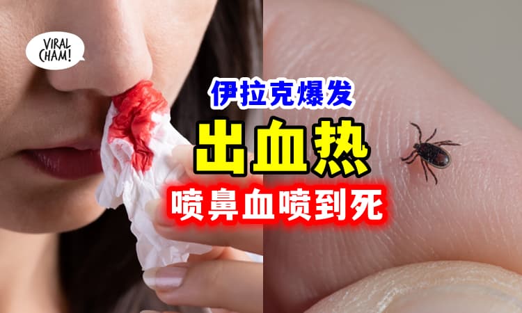 【无药医⚡】伊拉克爆发『恐怖出血热』😱 恐喷鼻血喷到死❗