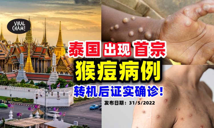 【越来越近了😱】泰国发现「首宗猴痘病例」⚡ 是一名转机旅客！