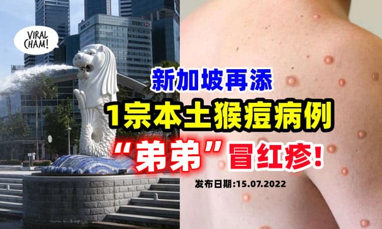 【生殖器官出现红疹😱】新加坡再添「1宗本土猴痘病例」⚡ 41岁男子染疫！