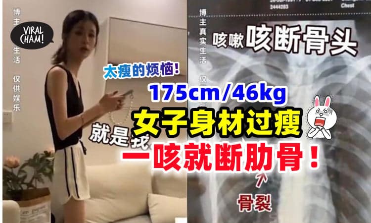 【太瘦也很烦❗】女子「175cm/46公斤」超扁身材⚡ 一咳嗽就咳断肋骨！