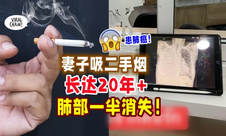 【🚬害惨枕边人】女子「吸丈夫二手烟」20多年⚡ 一半肺部竟“消失”😱 患肺癌末期！