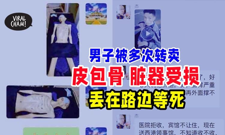 【惨不忍睹😢】28岁男子多次被转卖「瘦成皮包骨+脏器受损」⚡ 被丢路边等死….