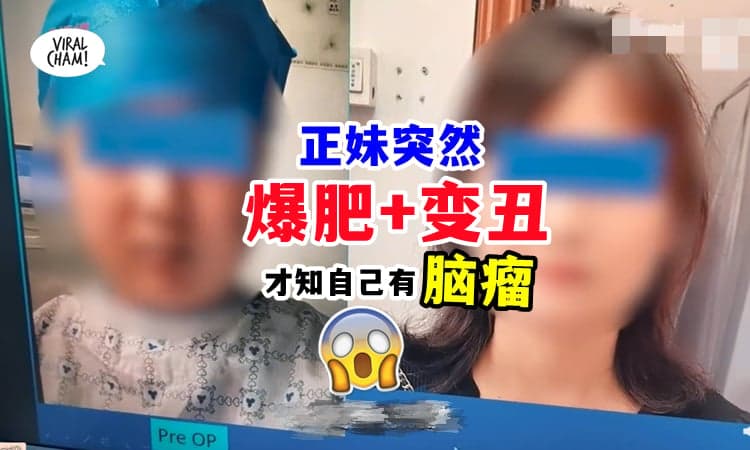 【医生都吓到❗】美女突然『体重爆肥+变丑』😱 紧急求医惊觉脑瘤⚡