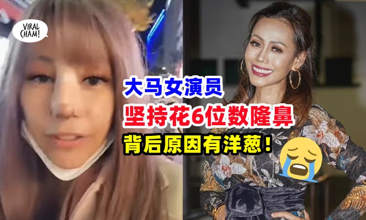 【四度隆鼻❗】大马女演员自爆『花费RM170,000隆鼻』⚡ 原因竟是19岁那年的创伤😭
