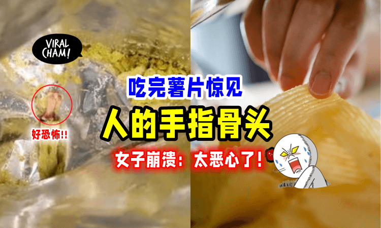 【差点呕出来🤮】薯片内疑似有「断指骨头😱」女子崩溃：吃完才发现‼️