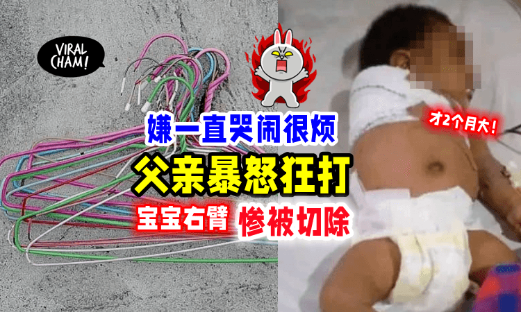 【太狠心了😡】被哭闹声吵醒「爸爸抄起衣架暴打」宝宝右臂惨被切除‼️😱