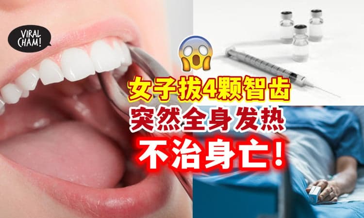 【麻醉过敏❗】女子拔4颗智慧牙🦷 身体突然出现高热🔥 不治身亡！