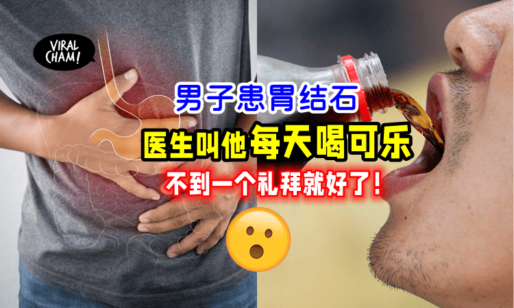 【喝Coke就好了⁉️】医生叫男子「每天喝可乐」胃结石不到一个礼拜就治好❗️