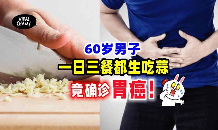 【别再当”仙家”啦‼️】60岁男子坚信「吃蒜能杀菌⚡️」3个月后被诊断患胃癌❗️