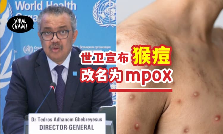 【避免有色人种污名化】WHO宣布将猴痘「英文改为mpox」🐒❌