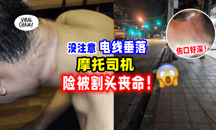 【差点被割断头😱】男子骑摩托「撞上垂落的缆线⚡️」脖子惨被严重划伤❗️