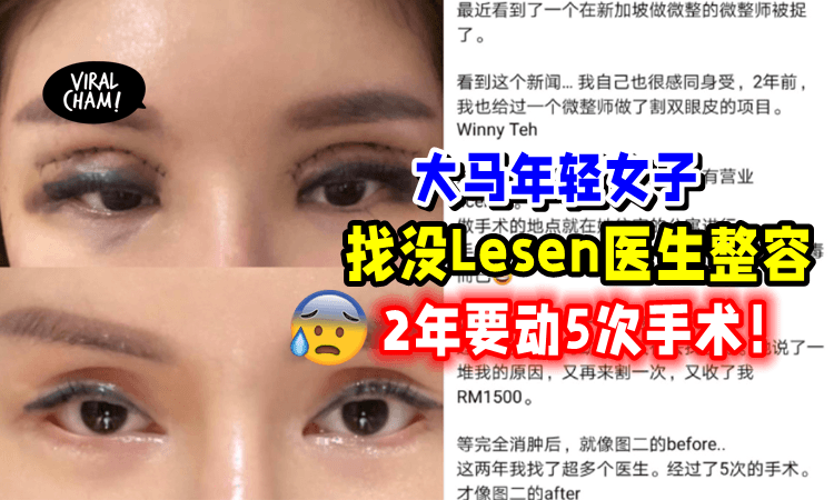 【花了RM6000❗️】大马女子「找无牌医生做手术⚡️」眼皮组织全损毁‼️