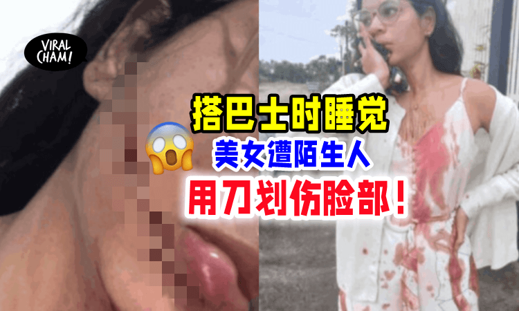 【终身毁容❗️】年轻女子「在巴士上睡觉⚡️」惨遭陌生人用刀割脸😱
