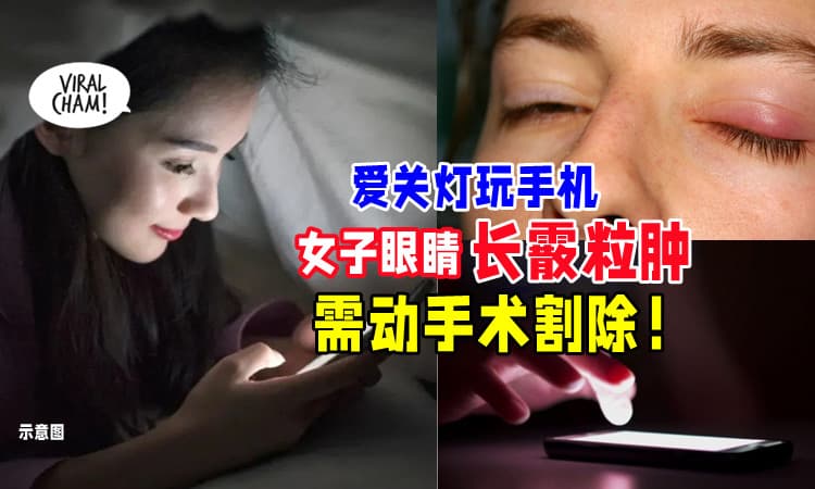 【坏习惯❌】22岁女子「睡前关灯滑手机📱」眼睛长霰粒肿，差点失明！