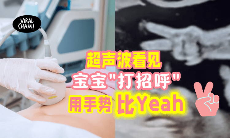 【超有镜头感😍】宝宝通过超声波「比V手势」医生惊呼: 从来没有看过😲