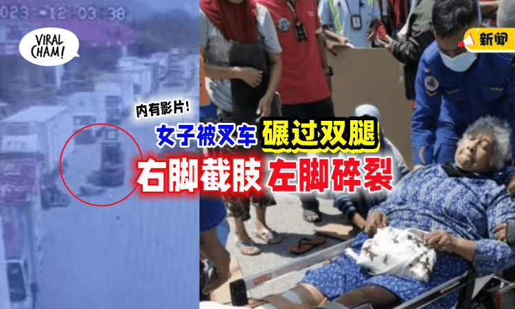 【太粗心了❗】疑似被货物遮挡视线⚡叉车直接「碾断人腿」(内有影片)
