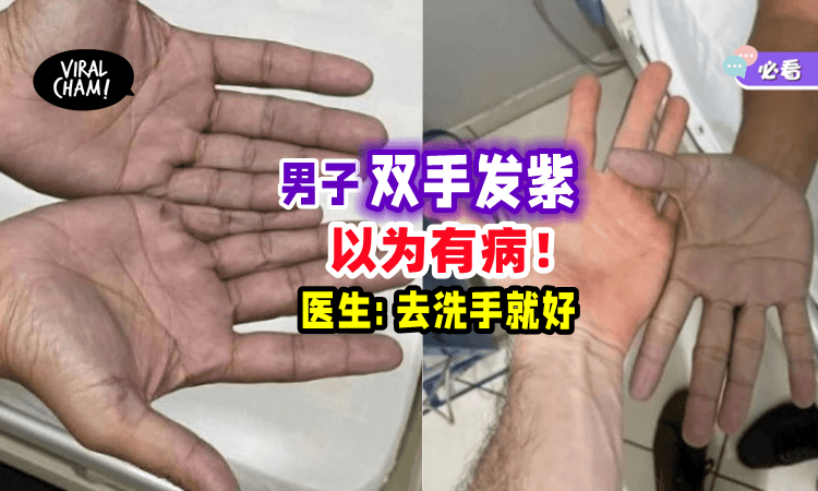 【白担心了😂】双手发紫去医院检查却没问题❓真相令人超傻眼！