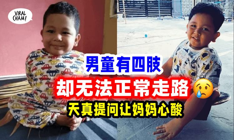 【心酸😭】7岁儿童拥有四肢却「天生腿短」问:妈妈,为什么只有我用手走路😢