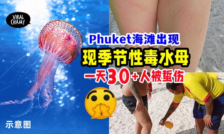 【有去海滩的旅客注意❗️】Phuket出现「毒水母⚡」1天就有超过30人被蜇伤😱