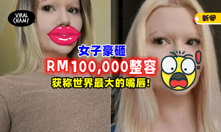 【全世界最大的嘴唇👄】女子为保住称号, 做43次整容手术+每月注射玻尿酸！