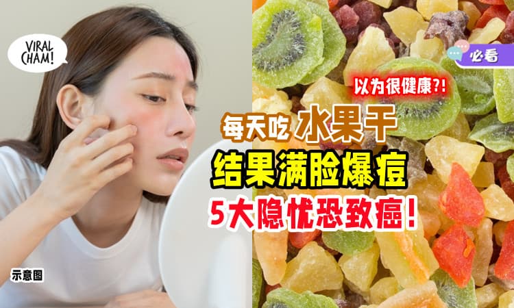 【5大隐忧恐致癌⚡】女子平日爱吃「水果干零食」竟导致满脸爆痘😱