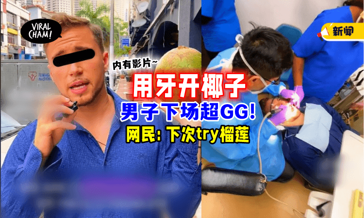 【医生也笑到不行🤣】外国男子「用牙开椰子🥥」结果下场超惨的！(内有影片)