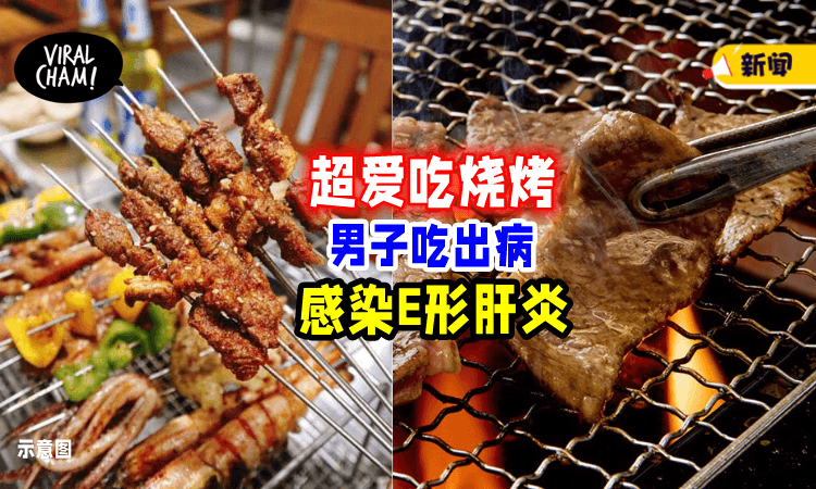 【顾着Enjoy, 忘了健康❗️】男子超爱吃烧烤, 结果「感染E形肝炎」搞坏身体⚡