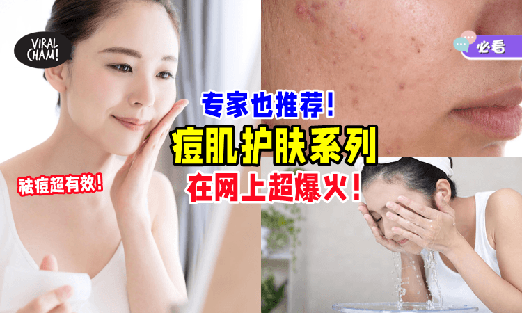 【超好用👍】这款由皮肤科测试的「痘肌护肤系列」在网络上超爆火🔥 祛痘安全又有效！