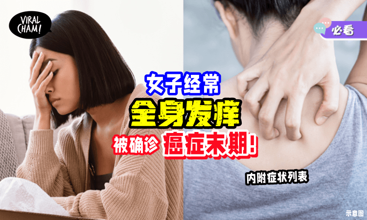 【平时很难发现の症状⚠】女子「全身很痒」就医竟确诊“癌症末期”😱
