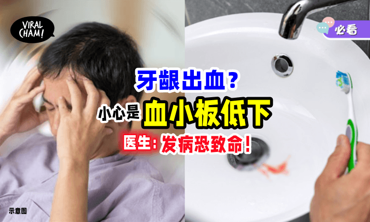 【牙龈出血要小心❗️】3原因导致「血小板减少」⚡ 医生警告：一旦发病恐致命！