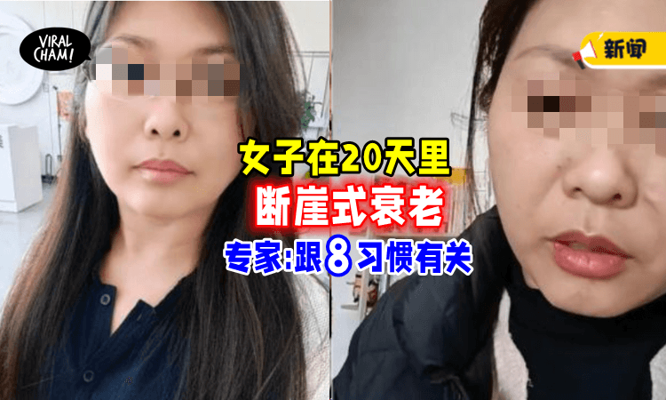 【变化超惊人❗】女子在20天里「迅速衰老😱」专家: 8个生活习惯加速老化!