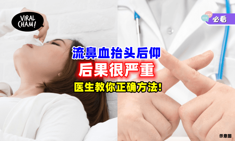 【止血应该这样做❗】流鼻血「抬头往后仰👃」医师警告：后果会更惨！