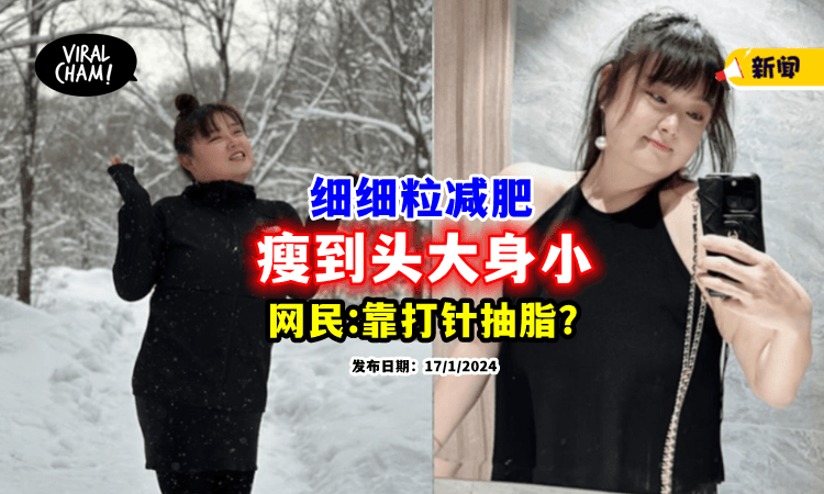 【身材比例不对❗】“细细粒”减肥「瘦身不瘦脸」网友质疑：打针抽脂了❓