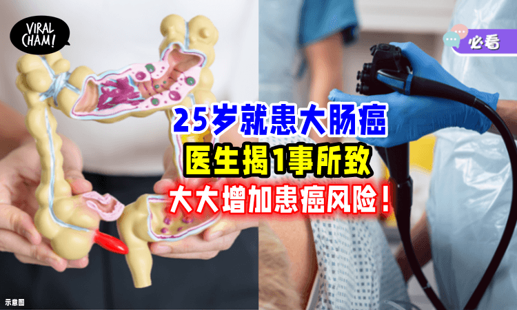 【出现4大高危因素要小心!】25岁就患大肠癌⚡ 医生揭「1种疾病」所致❗️