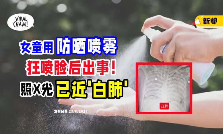 【狂咳+呕吐❗】7岁女孩拿「防晒喷雾」喷脸⚡ 送院照X光已近“白肺”！