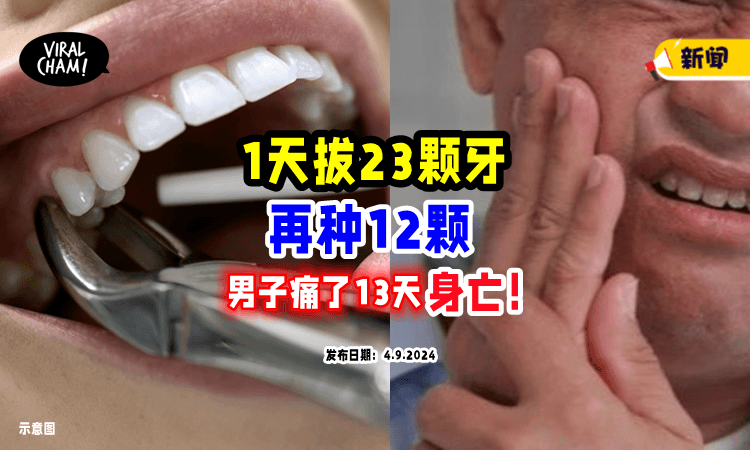【一次过拔完😱】男子一天内「拔牙23颗+种牙12颗」痛了13天后心脏骤停身亡❗️