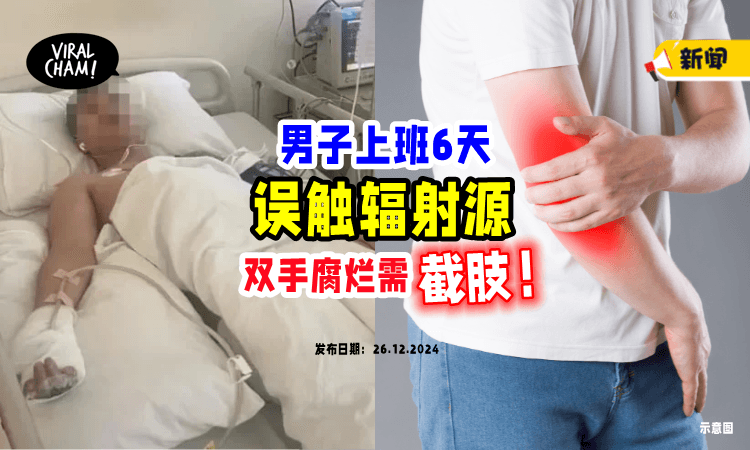 【才上班6天❗️】24岁男子误碰「辐射源」右手腐烂+手指弯曲😱 惨面临截肢风险！